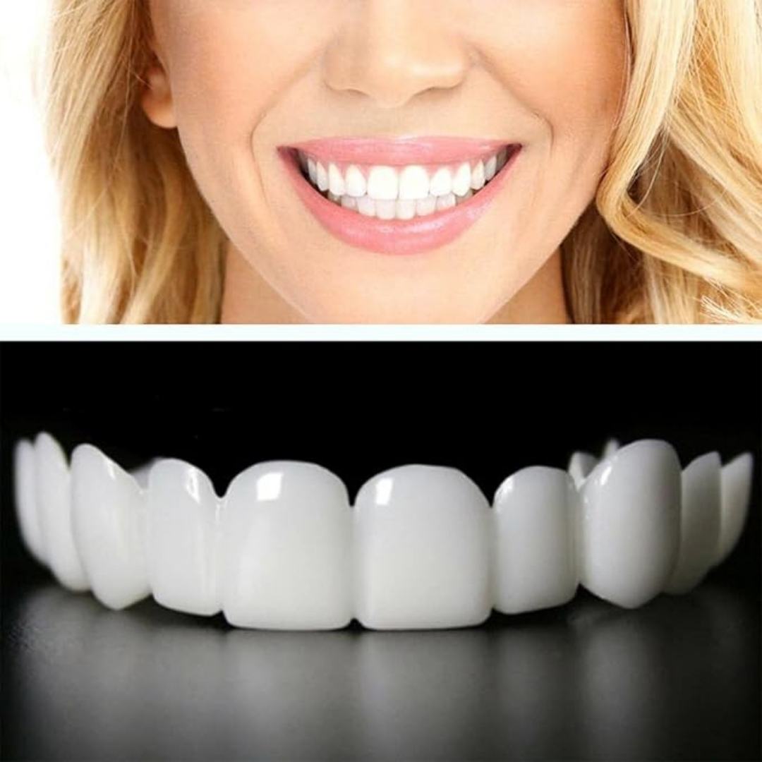 🦷 Diseño de sonrisa instantáneo, CARILLAS DENTALES Set x2 Pcs  (Superior + Inferior) 🦷